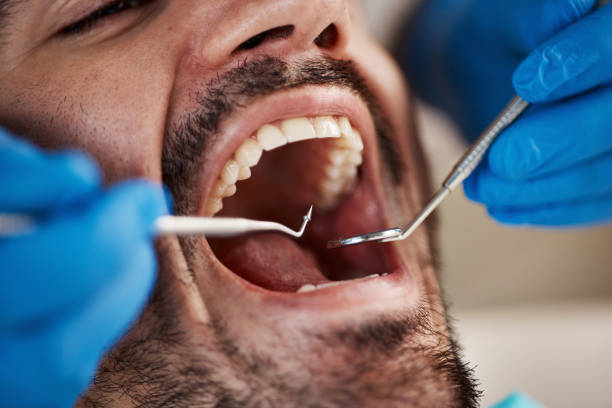 Best Emergency Tooth Extraction in Madison Center, CT