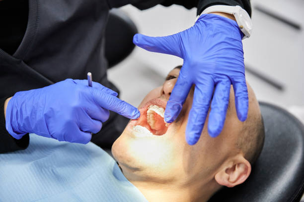 Best Emergency Root Canal Treatment in Madison Center, CT